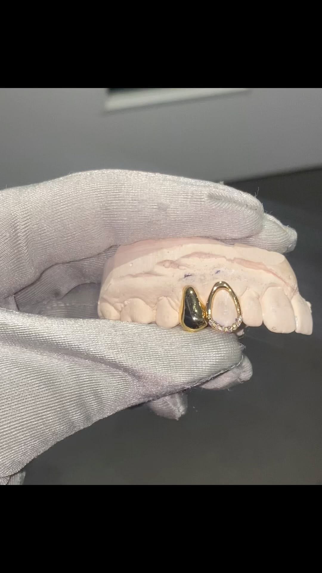 Post 8 by Grillz By The Tooth Fairy on Instagram (video)