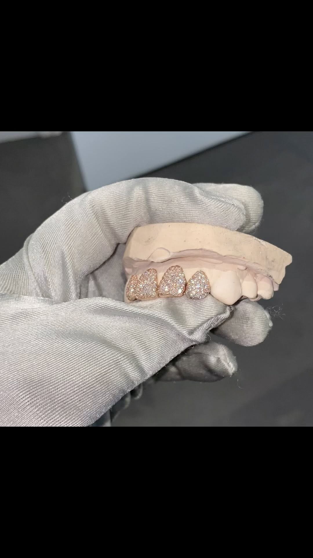 Post 5 by Grillz By The Tooth Fairy on Instagram (video)