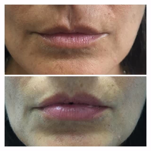 Post 1 by Dr Dray Clinic on Instagram (video)