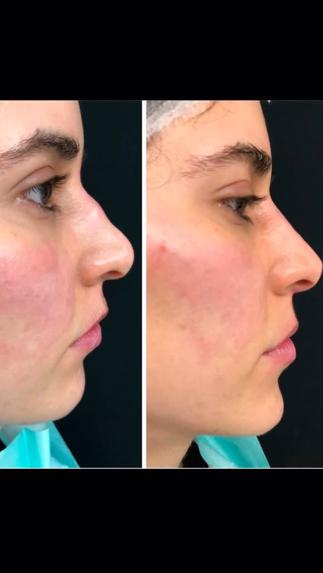 Post 6 by Dr Dray Clinic on Instagram (video)