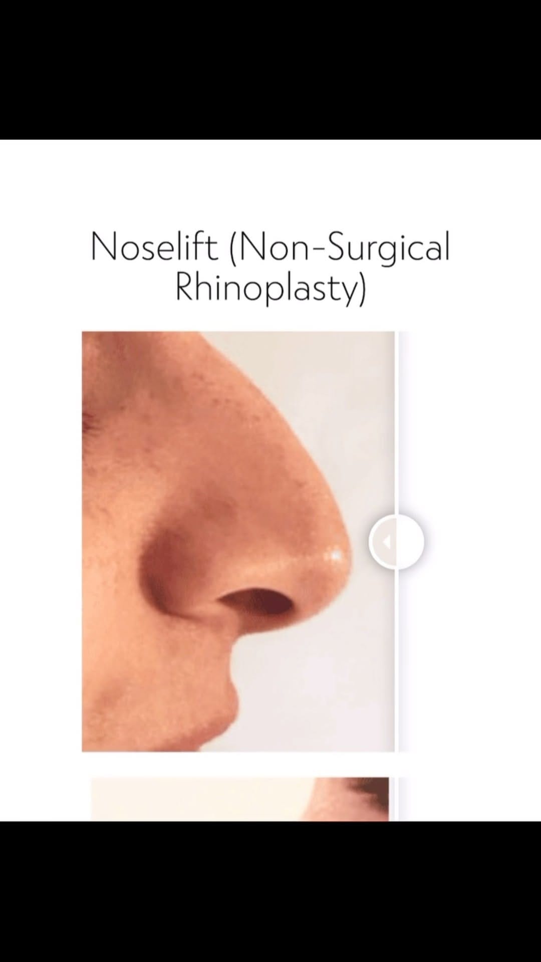 Post 4 by Dr Dray Clinic on Instagram (video)