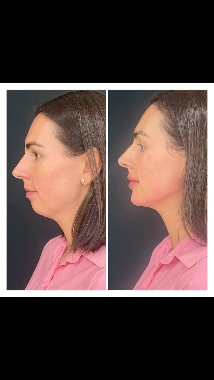 Post 9 by Dr Dray Clinic on Instagram (video)