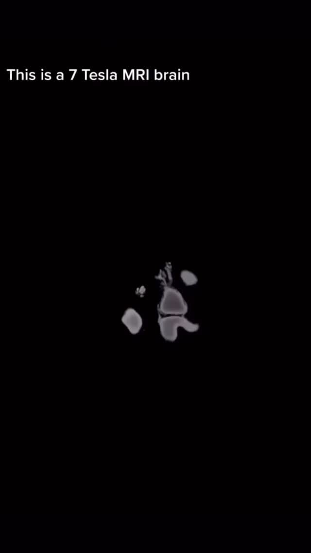 Post 5 by Dr.Aygun Badalova,BSc,MSc,Ph.D on Instagram (video)