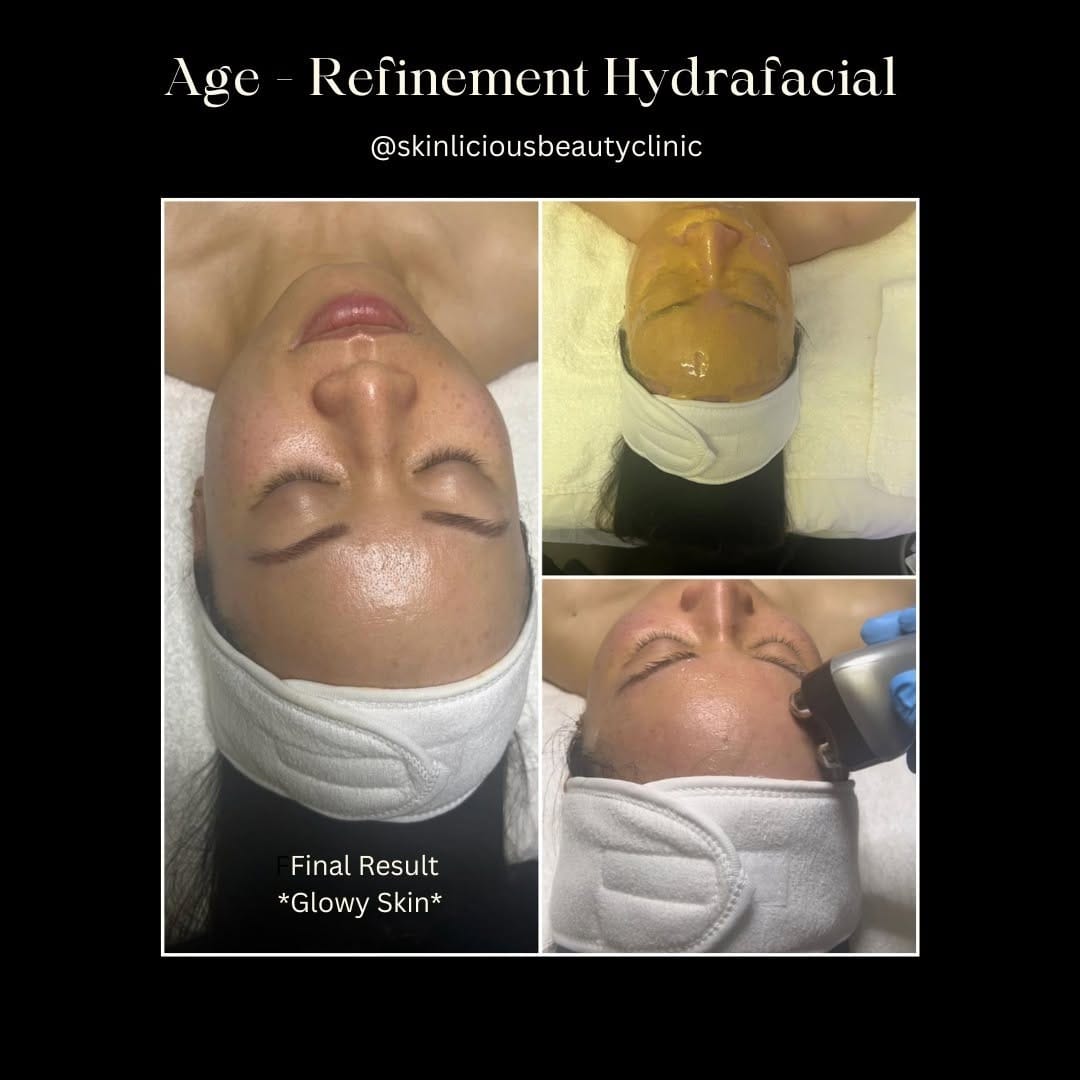 Post 8 by Skinliciousbeautyclinic on Instagram (image)