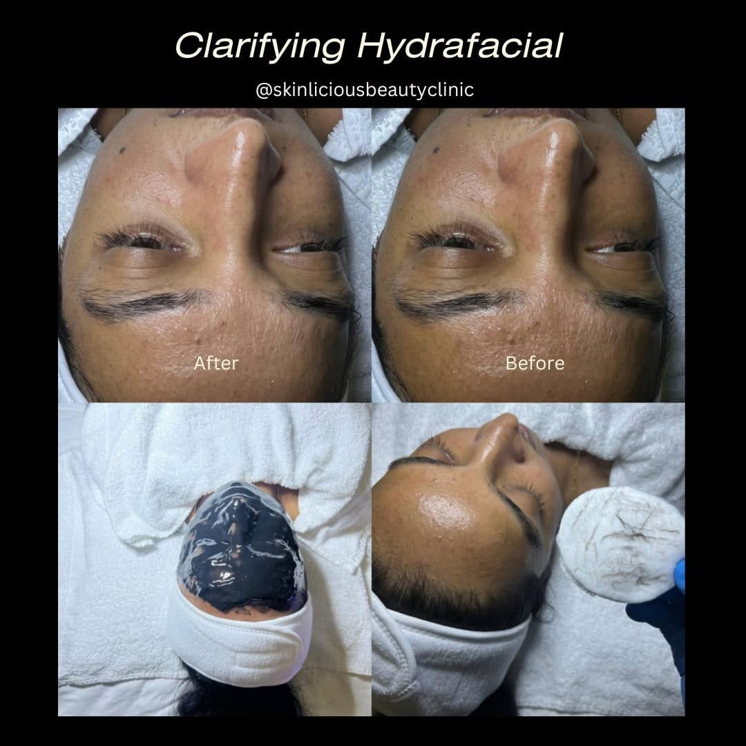 Post 6 by Skinliciousbeautyclinic on Instagram (image)