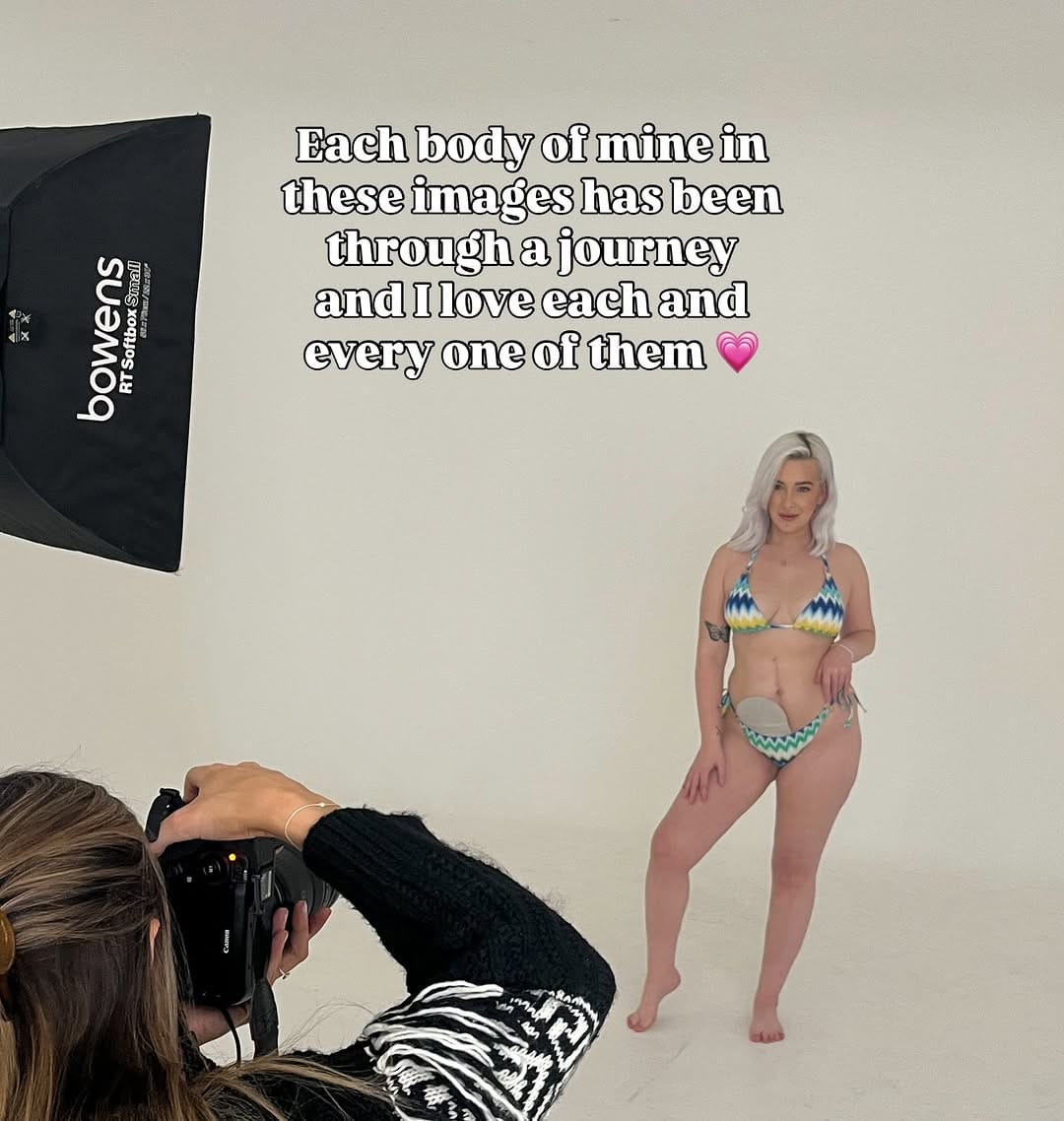 Post 3 by Phillipa | IBD & OSTOMY ♡︎ on Instagram (carousel)