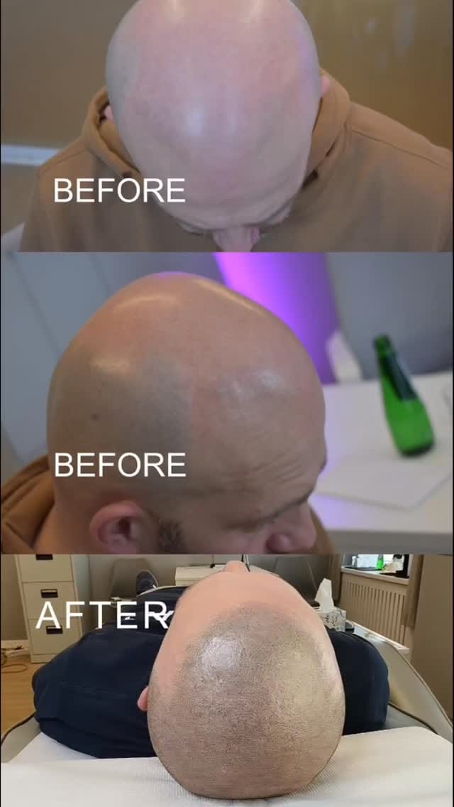 Post 1 by MW Aesthetics - Marek Waclawczyk on Instagram (video)