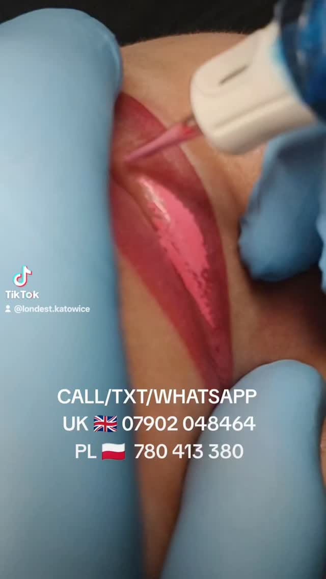 Post 3 by MW Aesthetics - Marek Waclawczyk on Instagram (video)