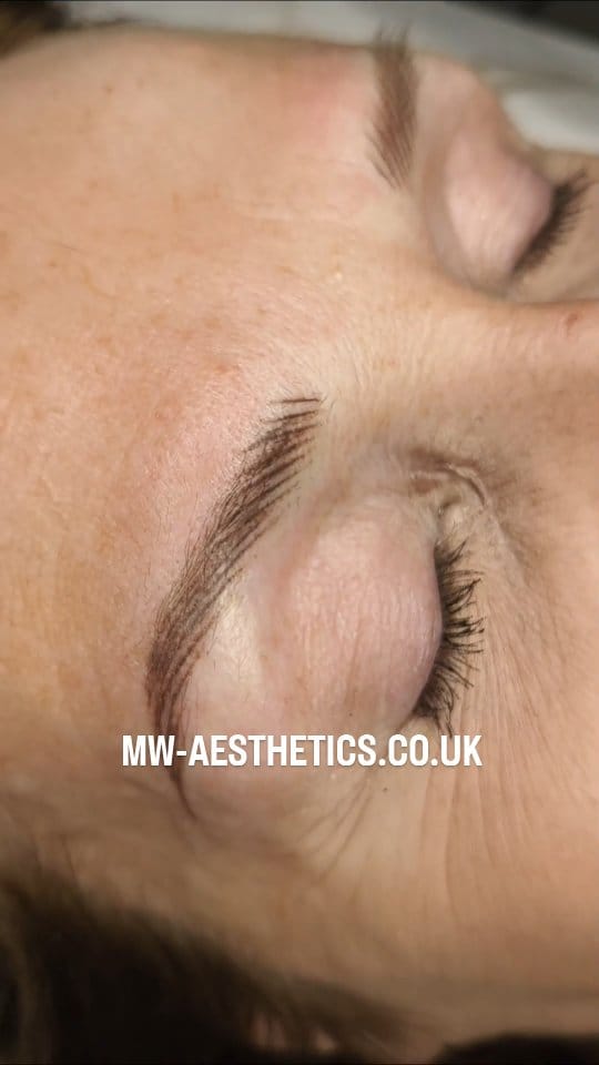 Post 7 by MW Aesthetics - Marek Waclawczyk on Instagram (video)