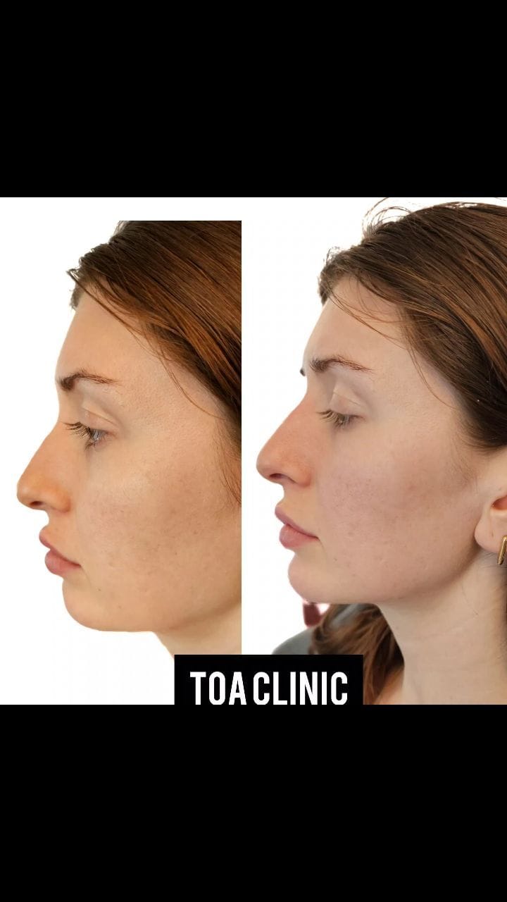 Post 9 by TOA Clinic on Instagram (video)