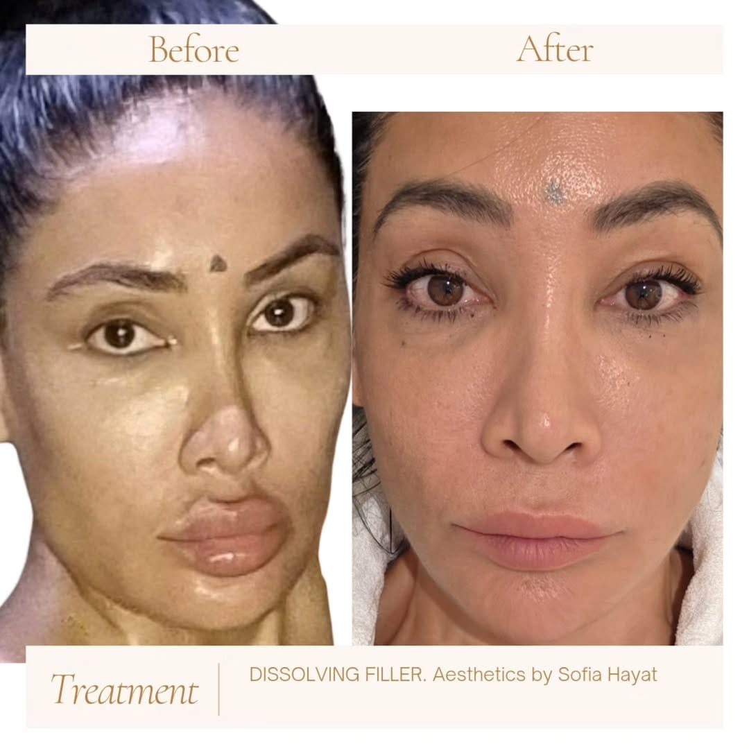 Post 4 by TOA Clinic on Instagram (image)