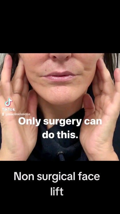 Post 8 by TOA Clinic on Instagram (video)