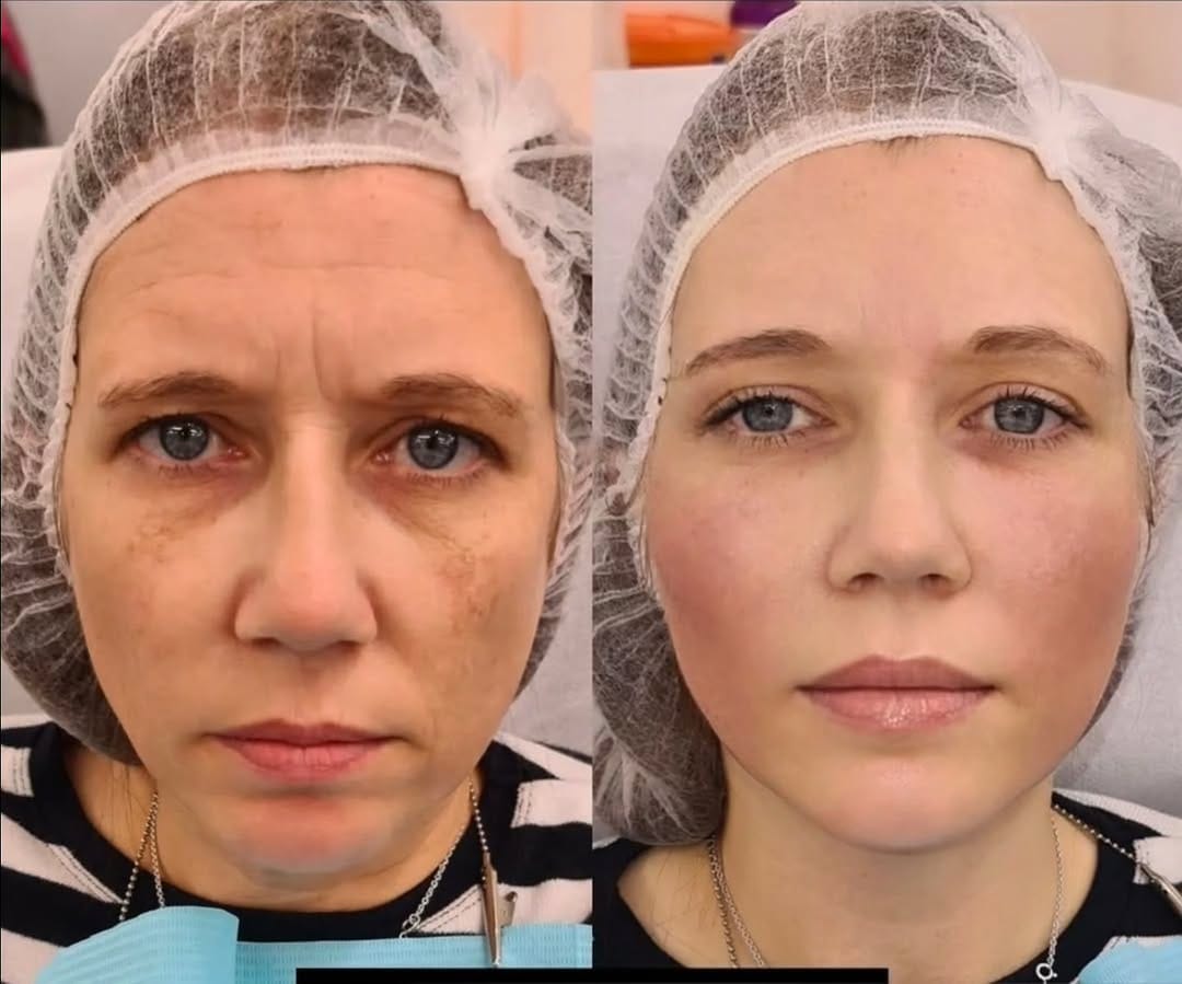 Post 3 by TOA Clinic on Instagram (image)