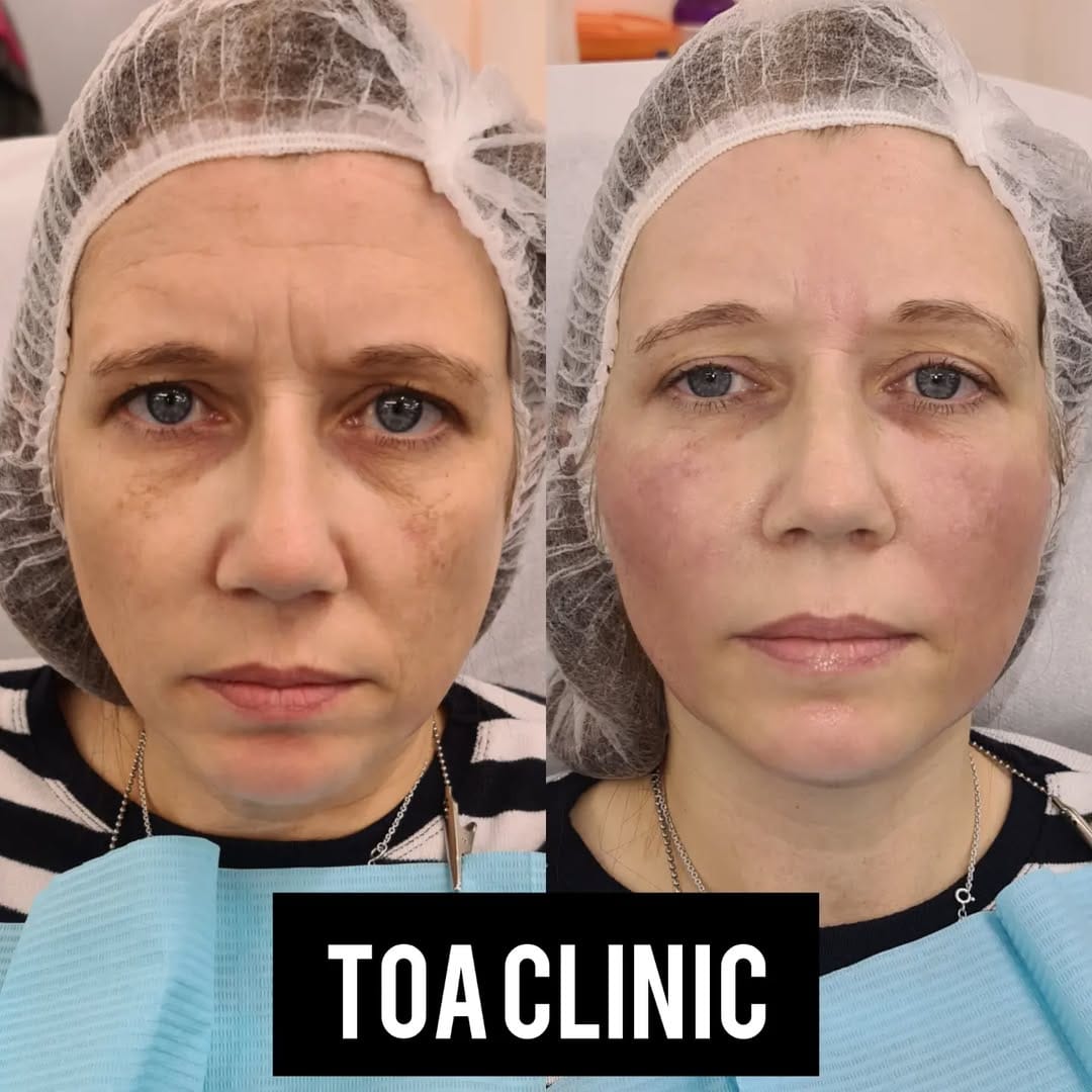 Post 10 by TOA Clinic on Instagram (image)