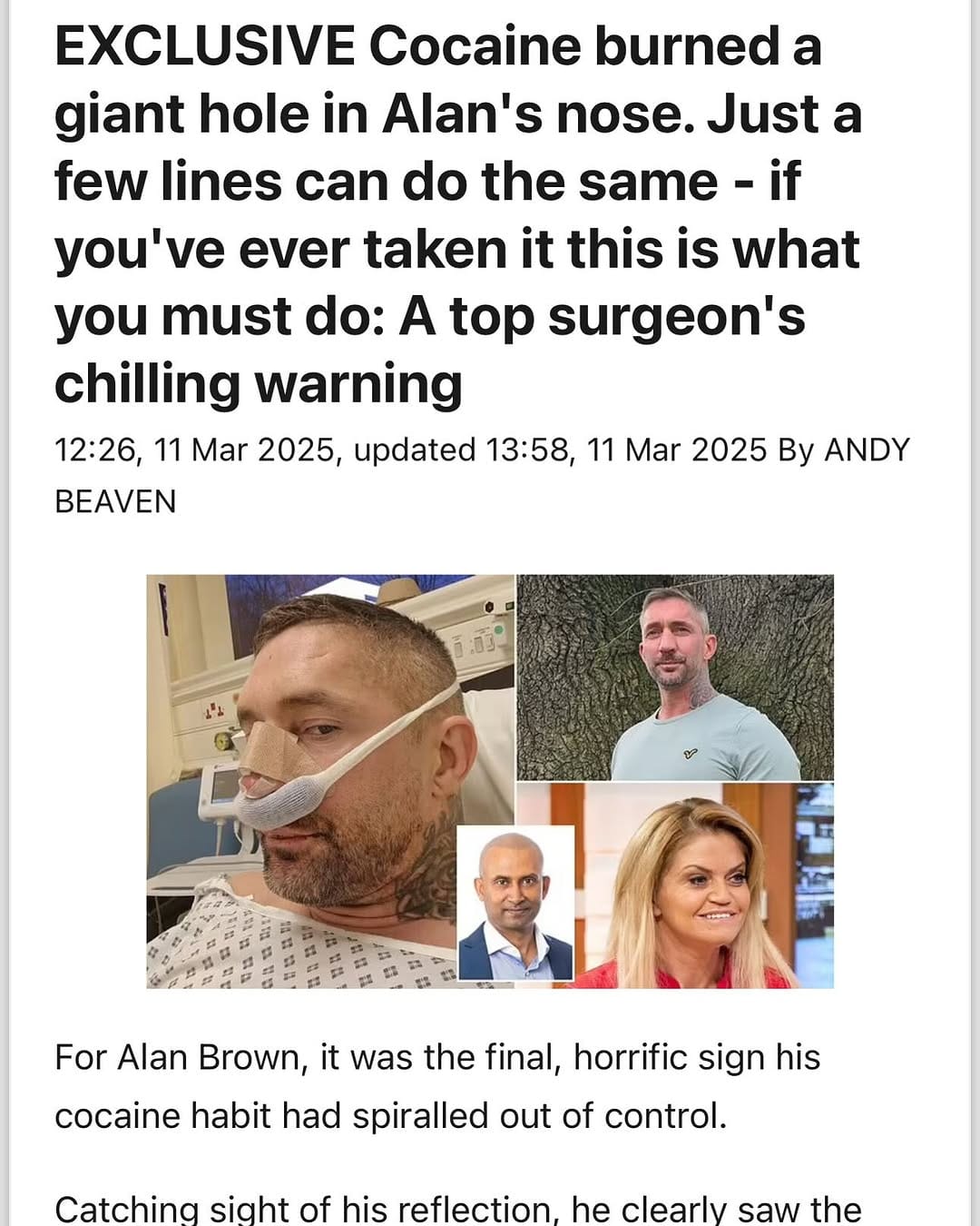 Post 7 by Anil Joshi FRCS, IBCFPRS | Facial Plastic Surgeon on Instagram (carousel)