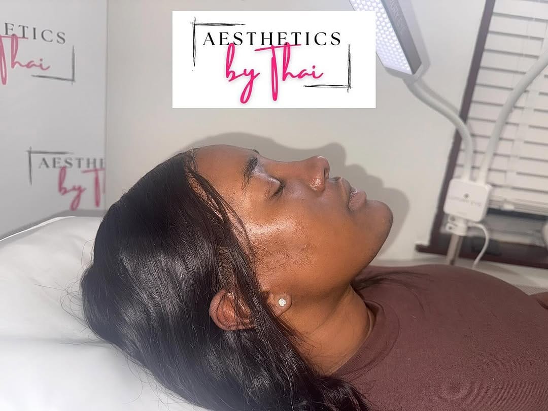 Post 9 by LIP FILLER | RUSSIAN LIPS | FILLERS | Aesthetics London on Instagram (image)
