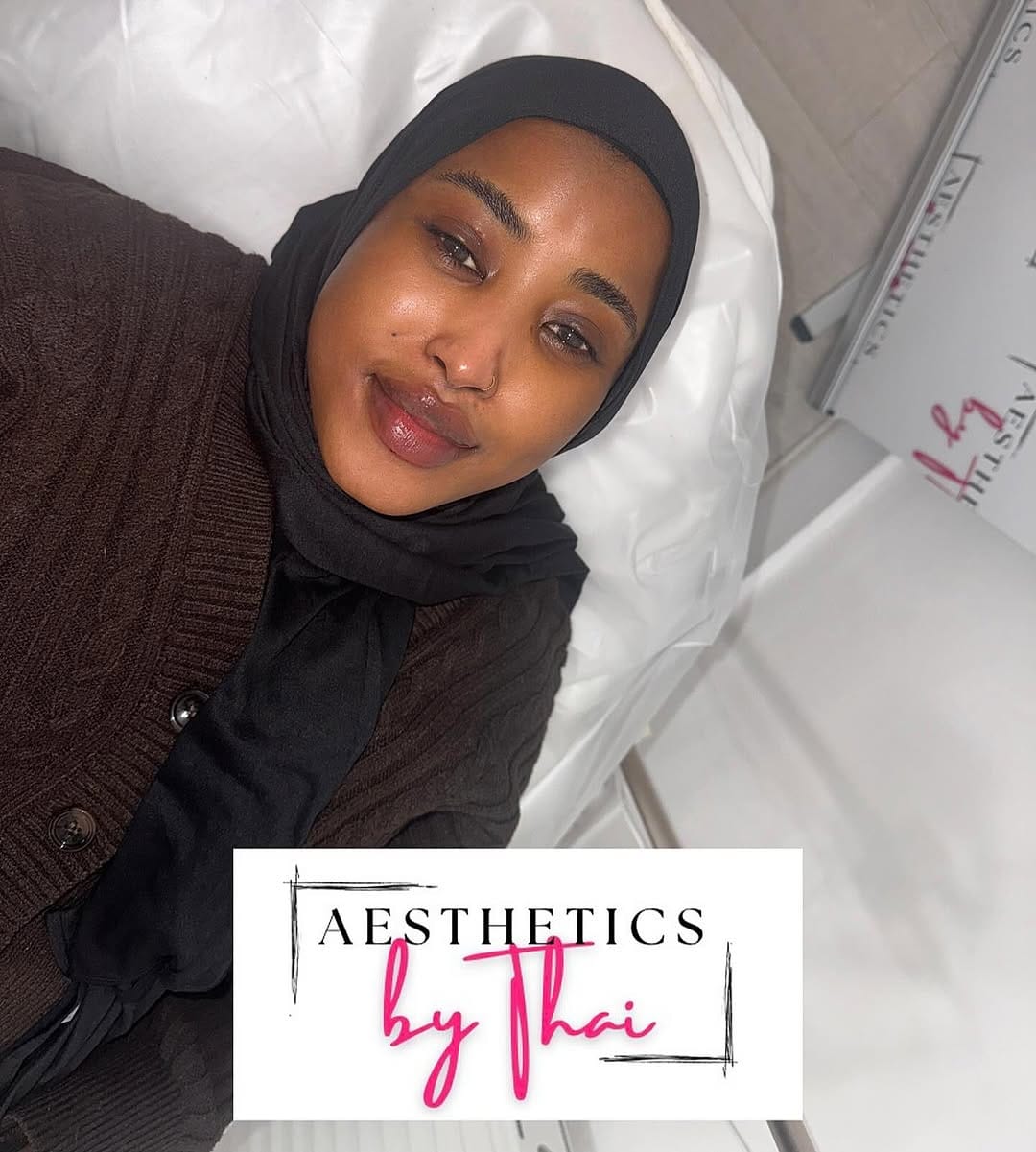 Post 5 by LIP FILLER | RUSSIAN LIPS | FILLERS | Aesthetics London on Instagram (image)