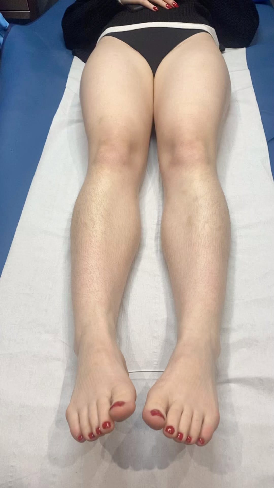 Post 10 by Hair Removal Specialist Stockport on Instagram (video)