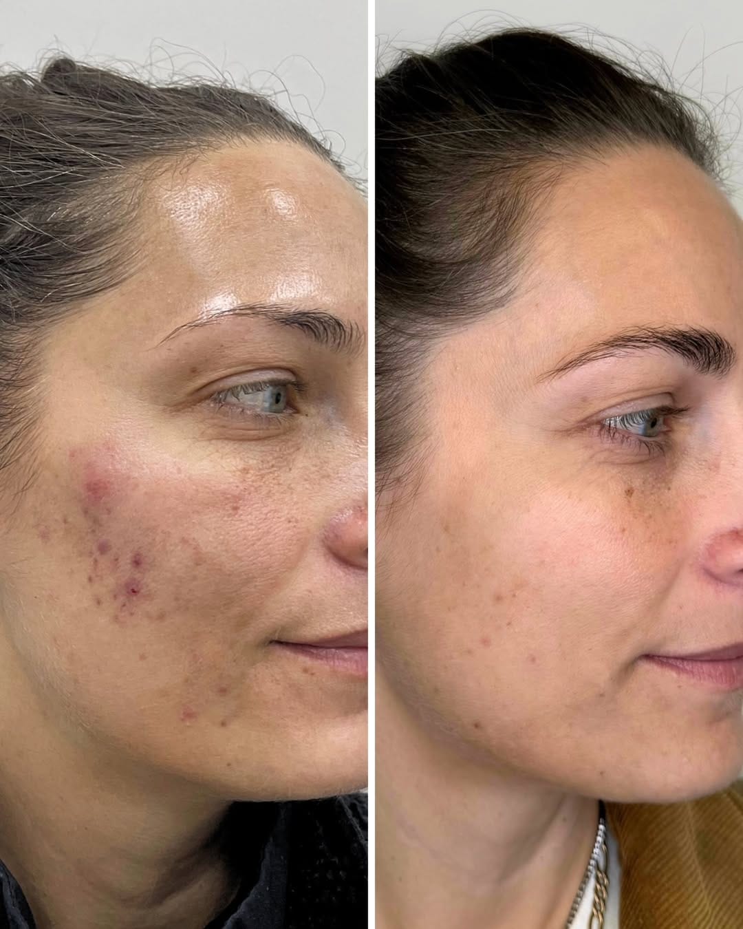 Post 8 by Eterno Aesthetics Skin Clinic on Instagram (carousel)