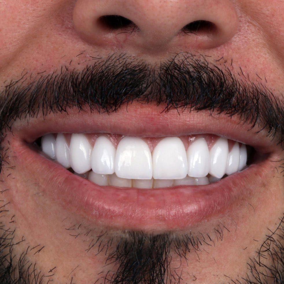 Post 2 by Aesthetic smile on Instagram (image)