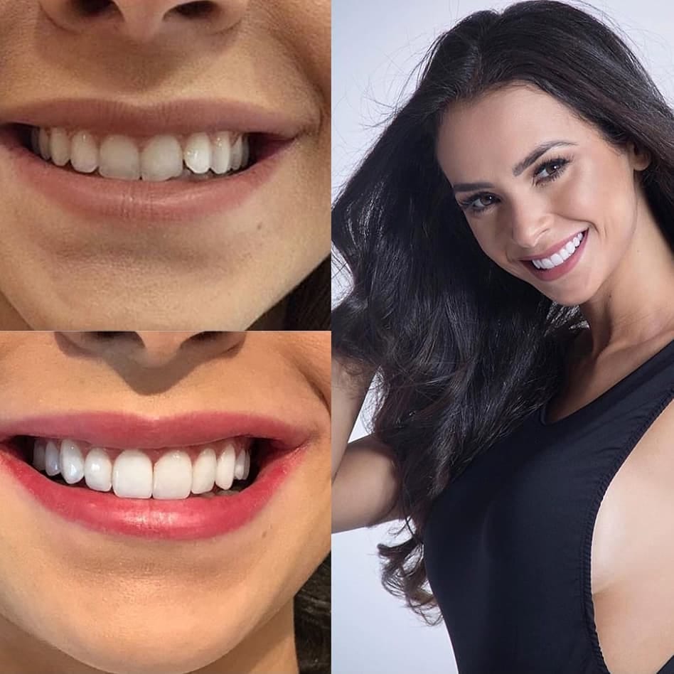 Post 6 by Aesthetic smile on Instagram (image)
