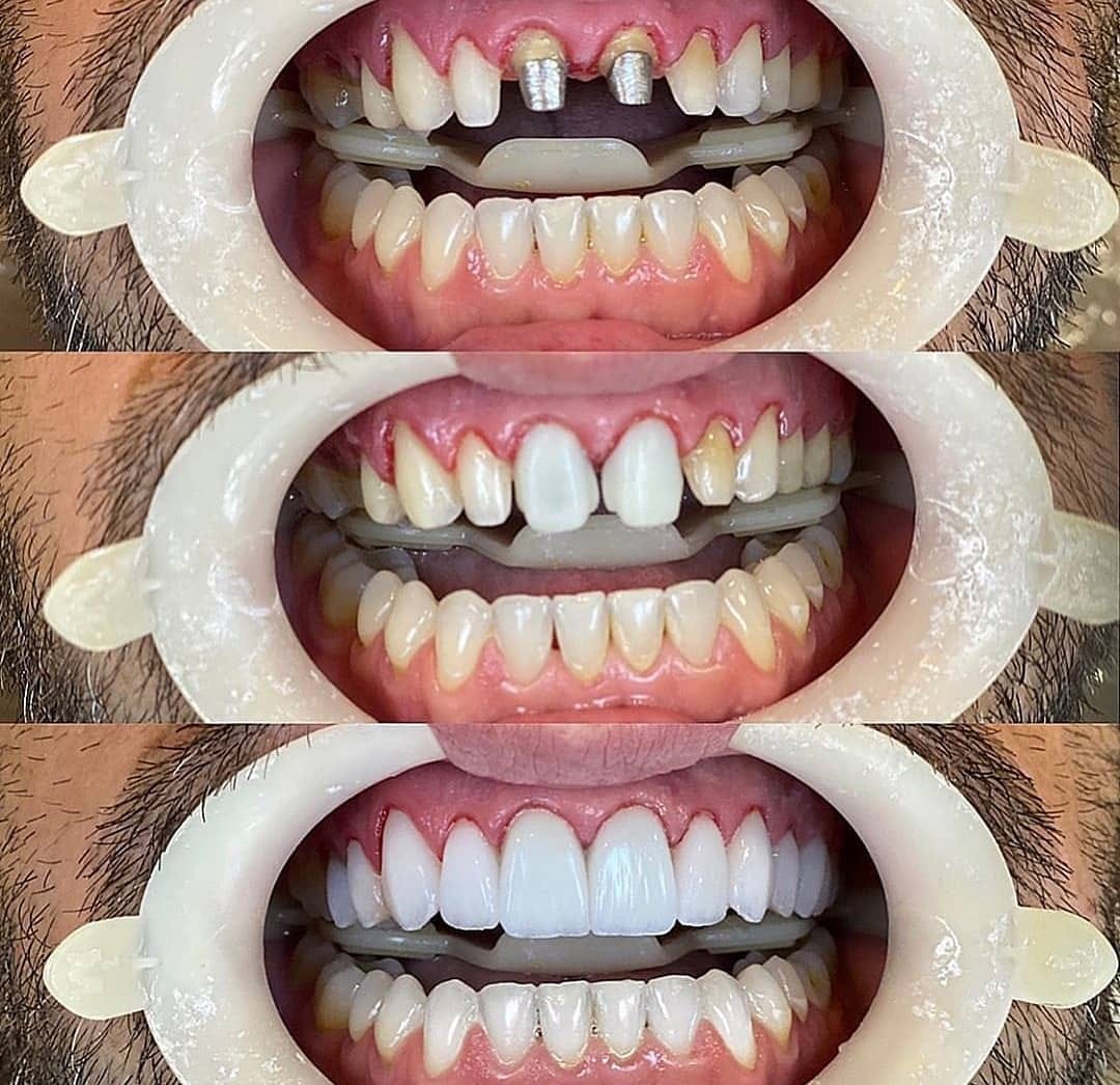 Post 10 by Aesthetic smile on Instagram (image)