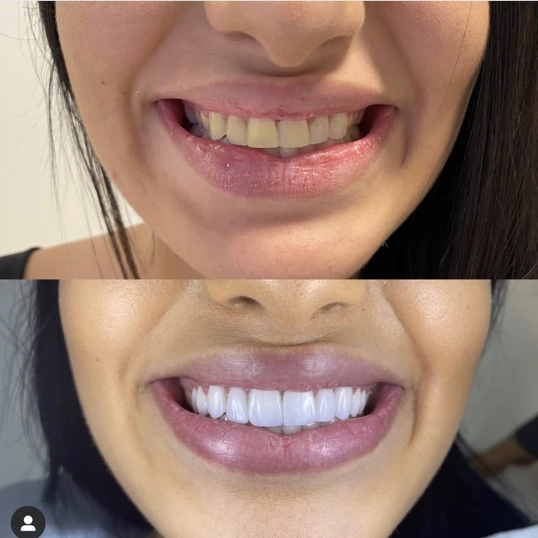 Post 5 by Aesthetic smile on Instagram (image)