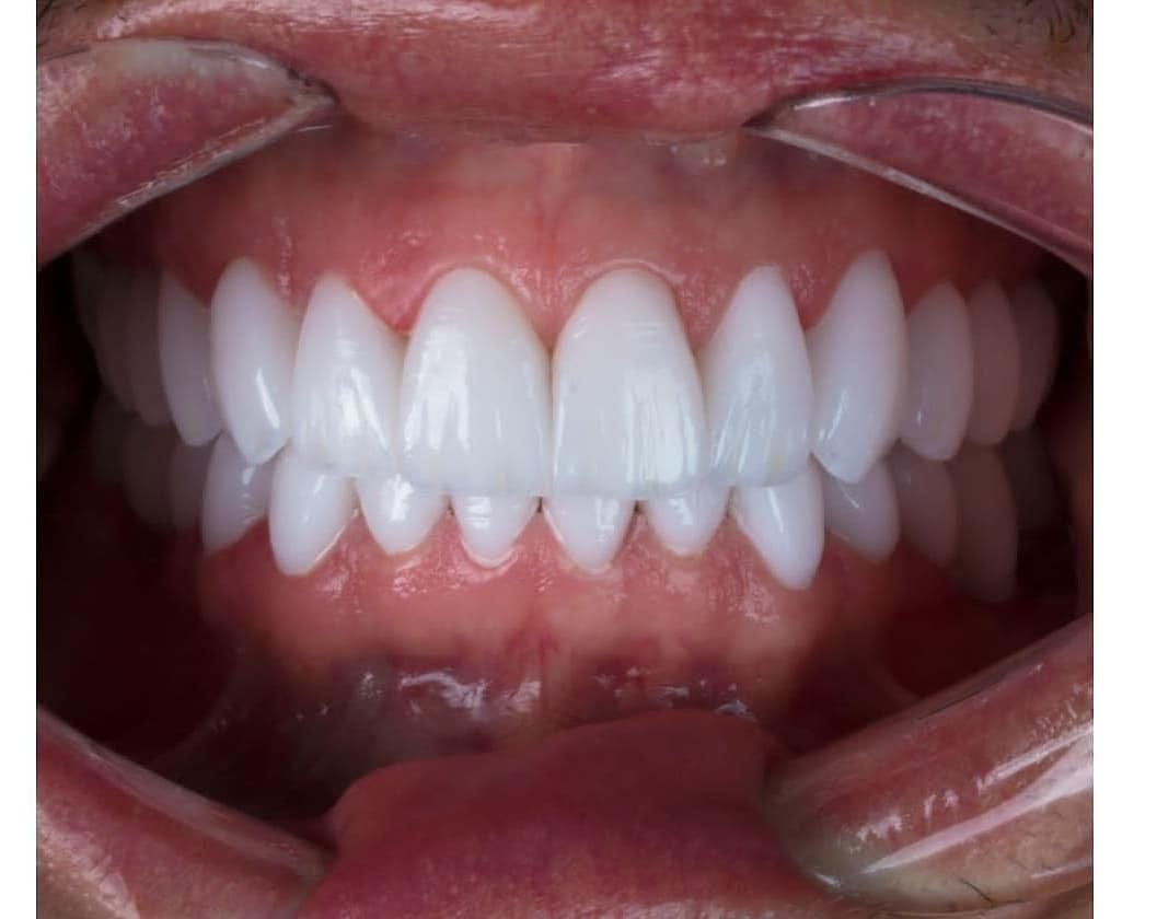 Post 1 by Aesthetic smile on Instagram (image)