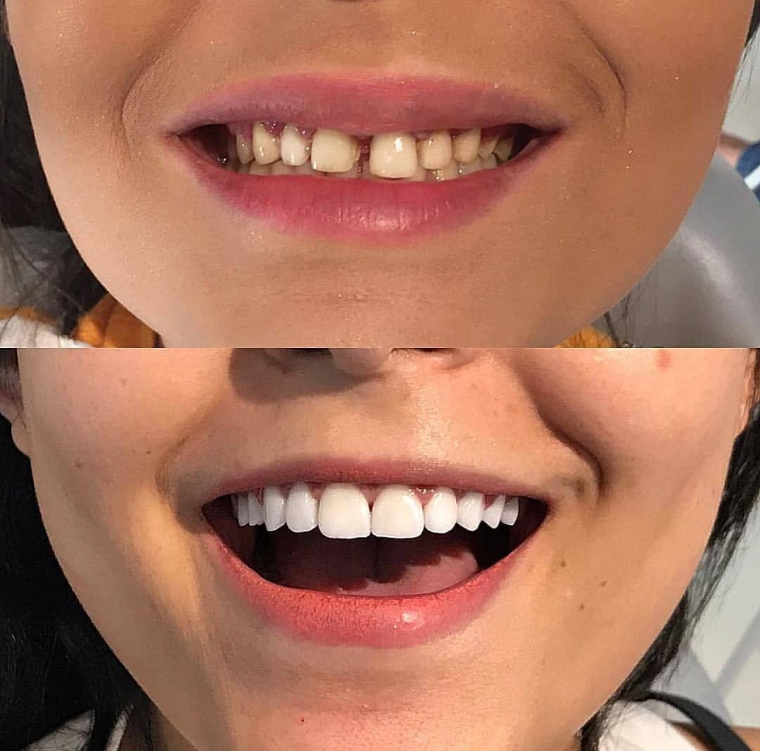 Post 8 by Aesthetic smile on Instagram (image)