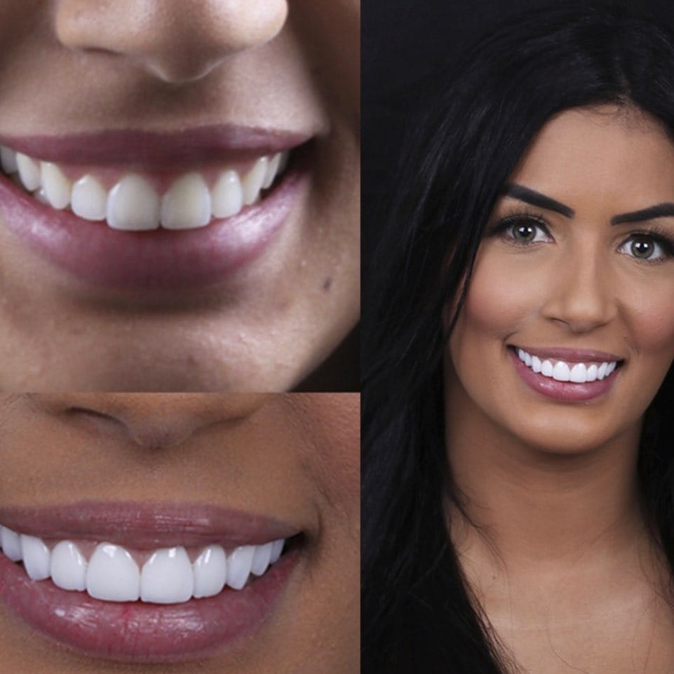 Post 3 by Aesthetic smile on Instagram (image)
