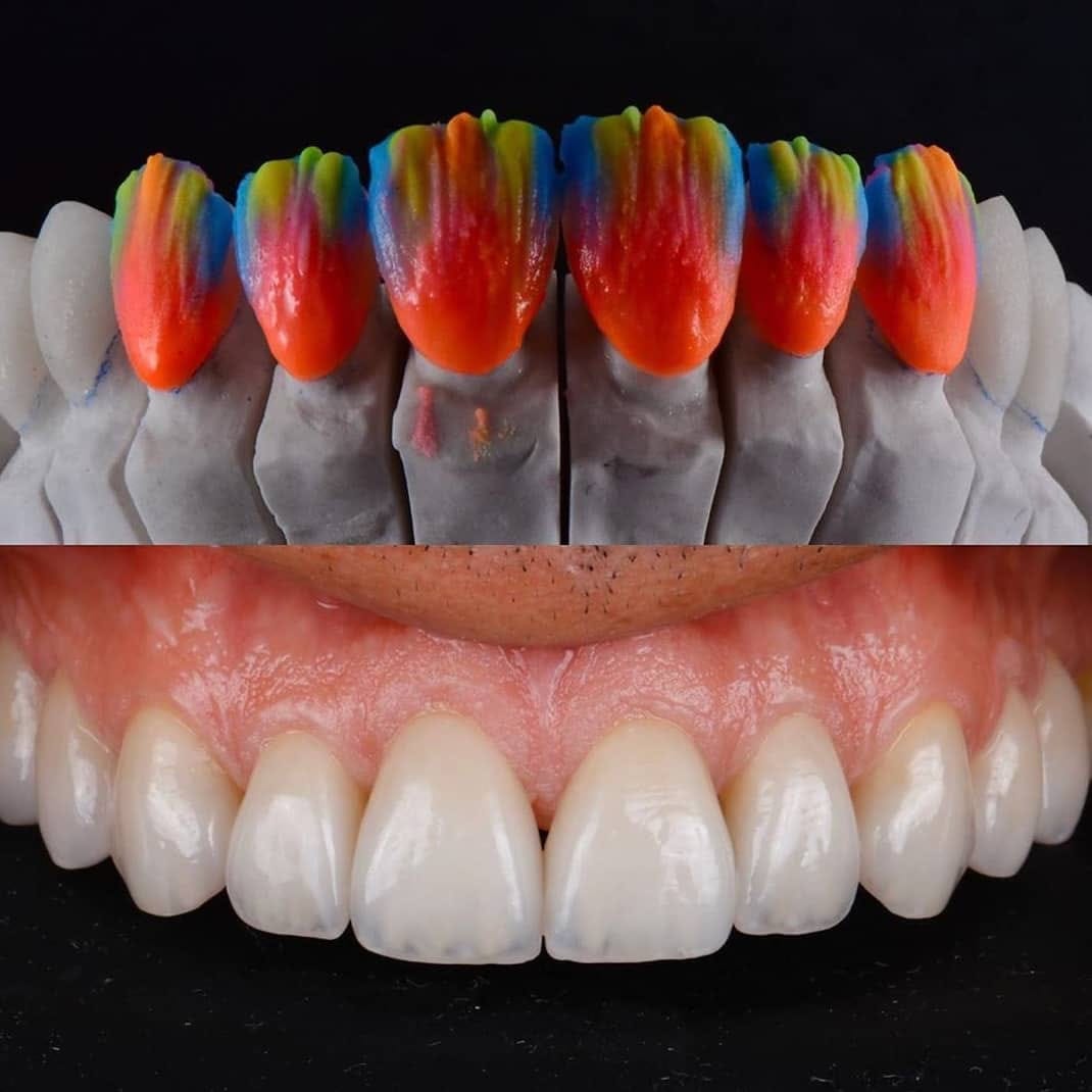 Post 7 by Aesthetic smile on Instagram (image)