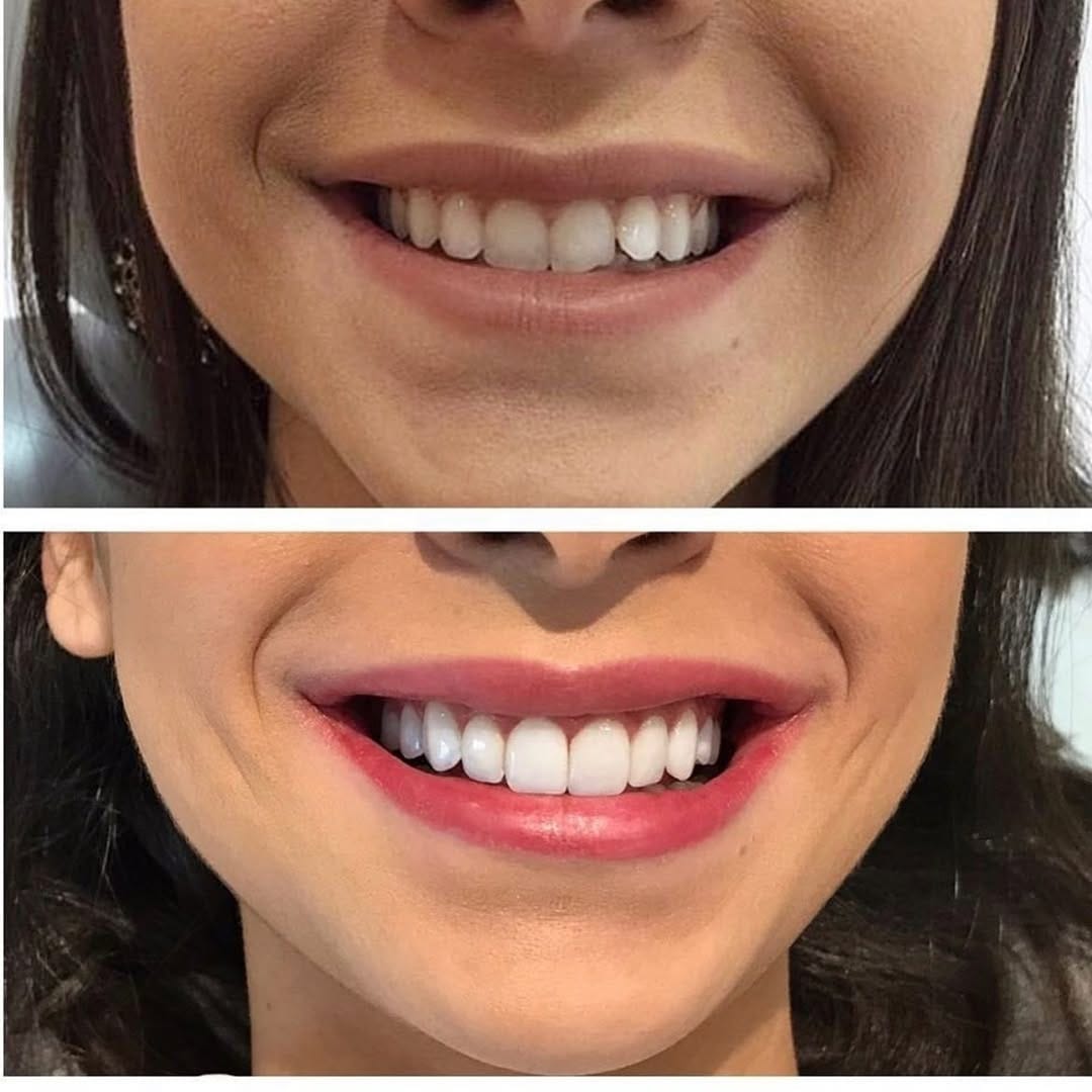 Post 4 by Aesthetic smile on Instagram (image)
