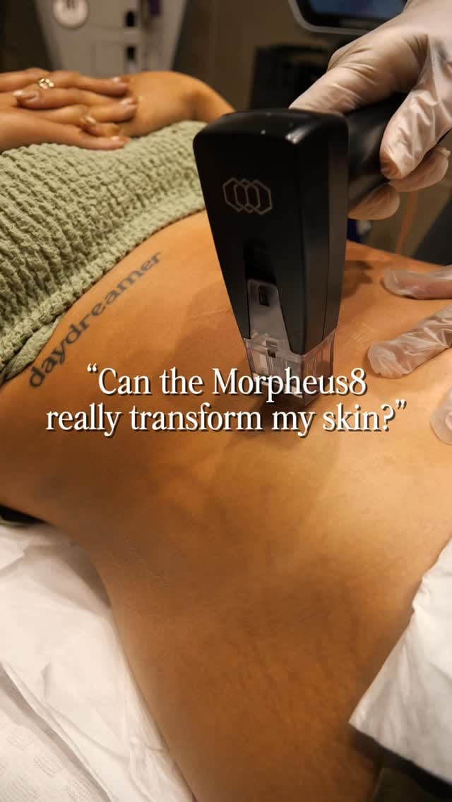 Post 5 by HC MedSpa on Instagram (video)