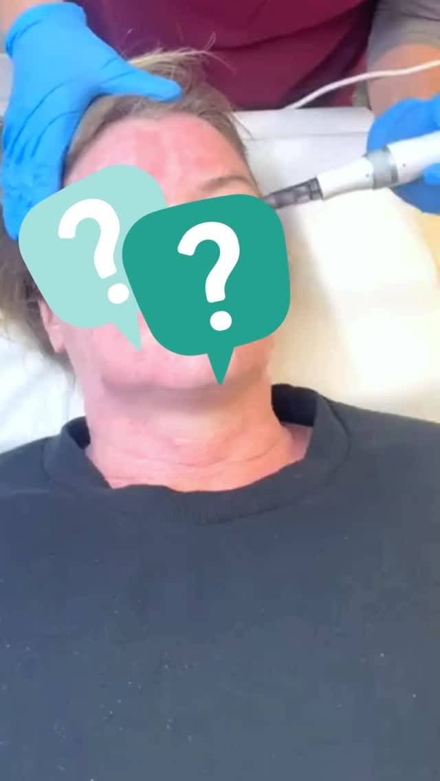 Post 10 by Look Lovely London | Medical Aesthetics on Instagram (video)