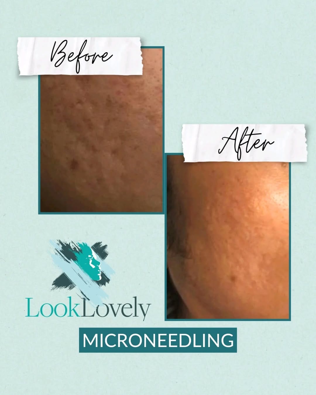 Post 3 by Look Lovely London | Medical Aesthetics on Instagram (image)