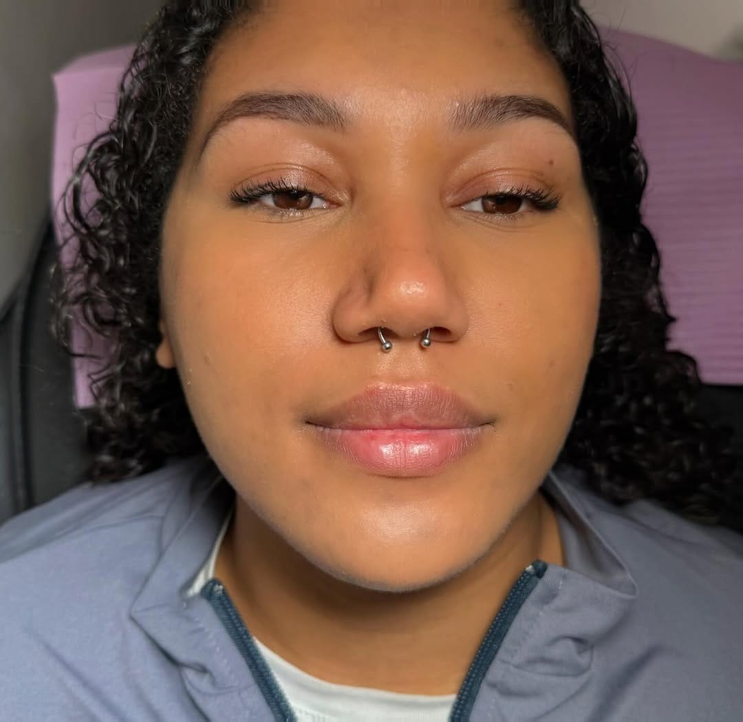 Post 3 by Lip Filler • Lash Tech • Lip Neutralisation • Hackney 🇬🇧 on Instagram (carousel)