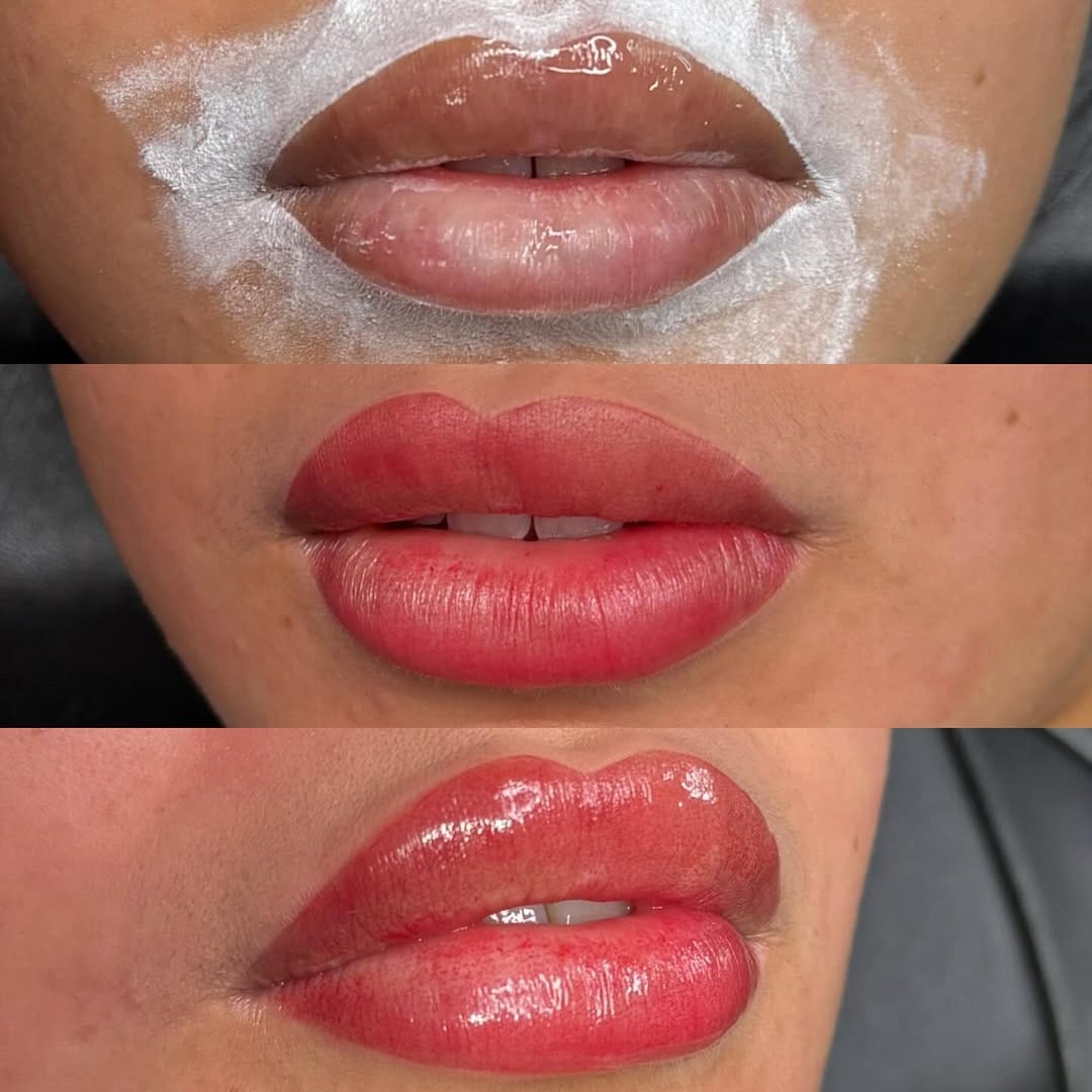 Post 5 by Lip Filler • Lash Tech • Lip Neutralisation • Hackney 🇬🇧 on Instagram (image)