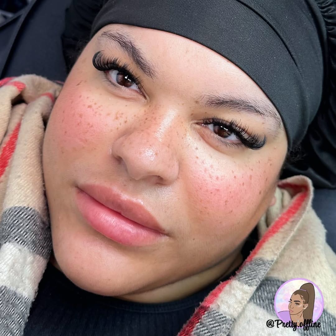 Post 7 by Lip Filler • Lash Tech • Lip Neutralisation • Hackney 🇬🇧 on Instagram (carousel)