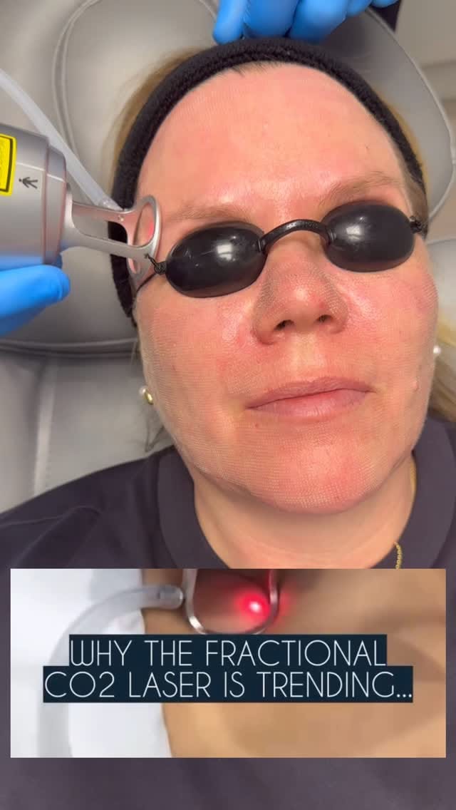 Post 4 by Dermoperfection Medical Skin & Aesthetics on Instagram (video)
