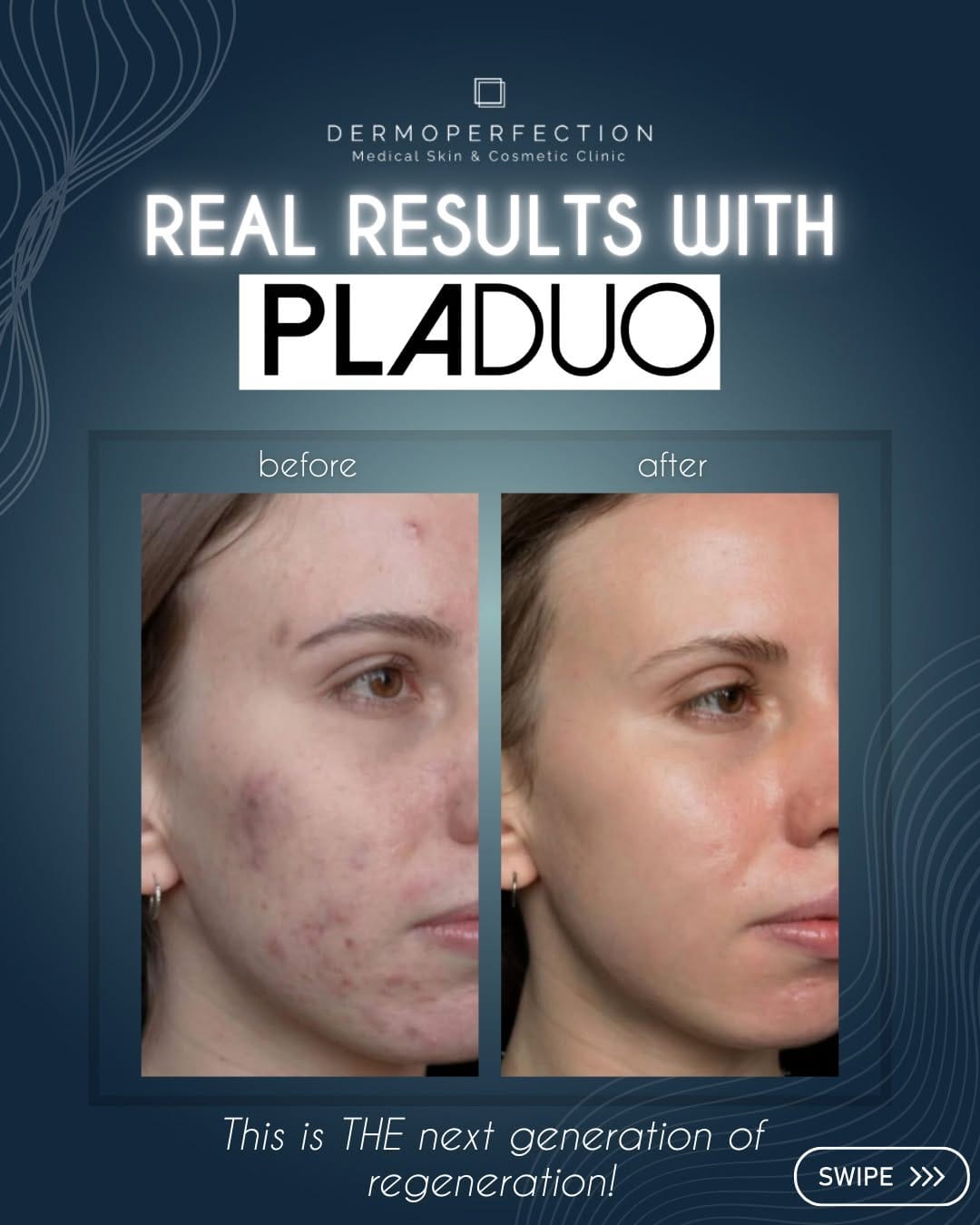 Post 5 by Dermoperfection Medical Skin & Aesthetics on Instagram (carousel)
