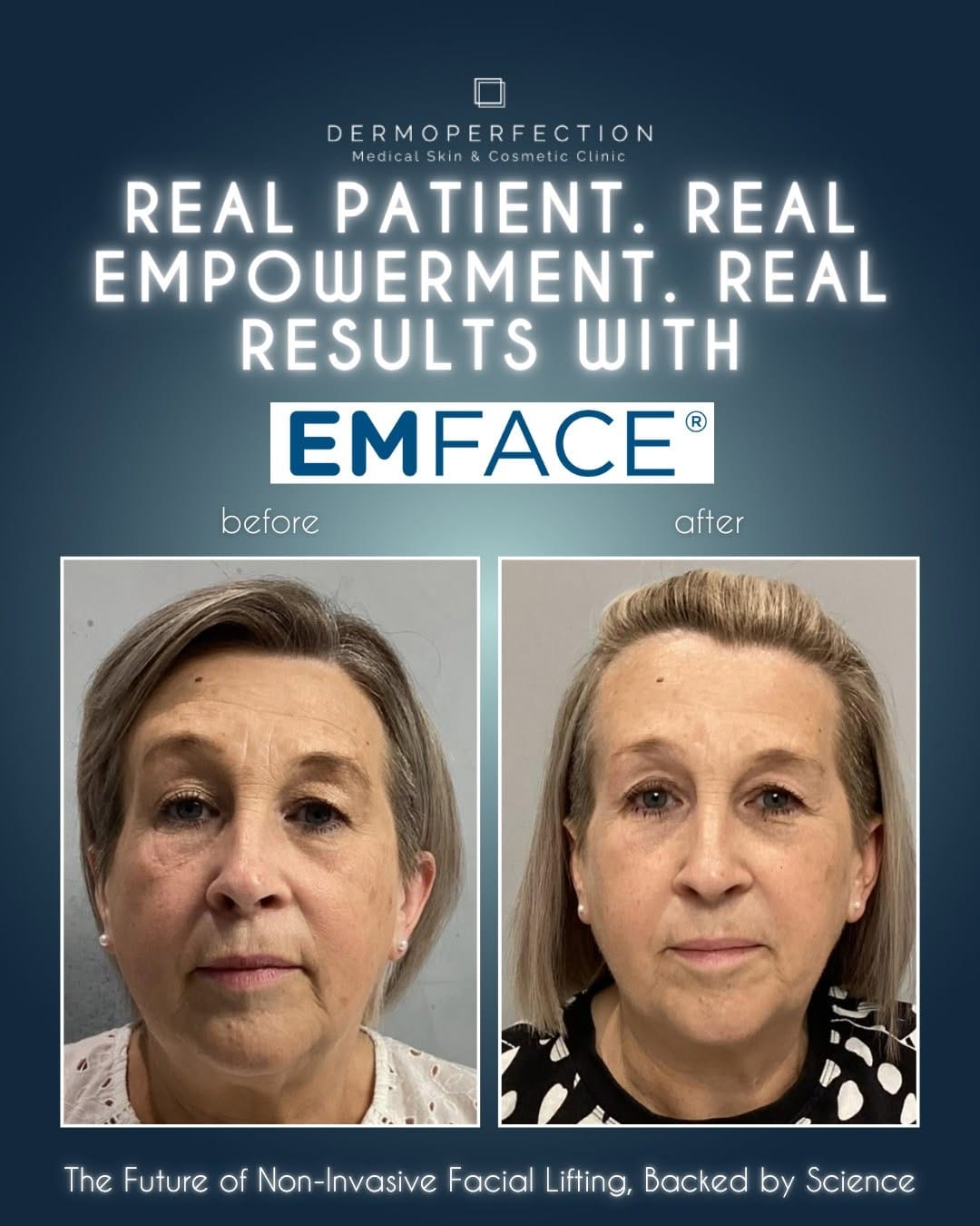 Post 3 by Dermoperfection Medical Skin & Aesthetics on Instagram (image)