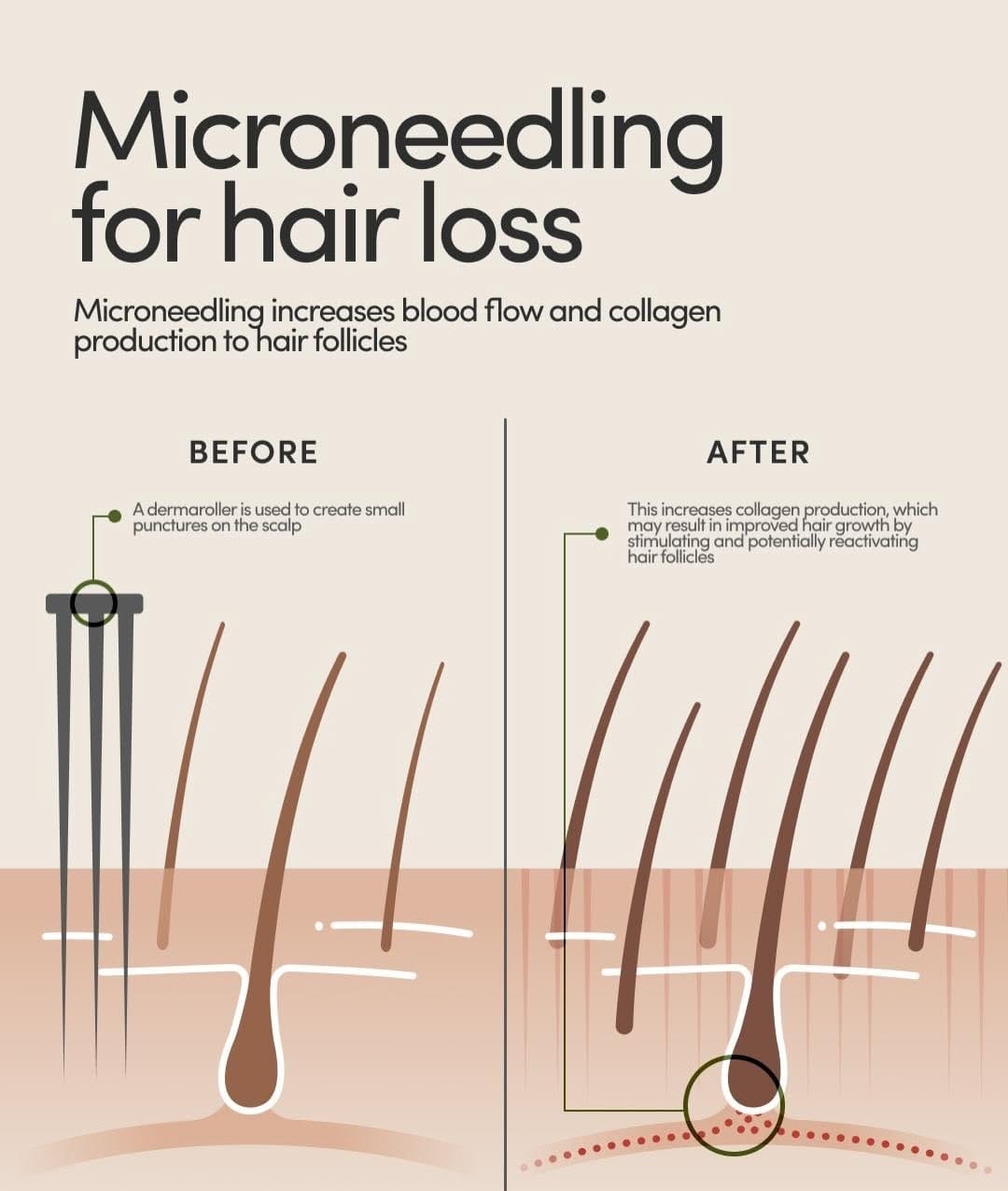 Post 2 by Keratin/Botox/Nanoplastia/Hair Loss/ on Instagram (carousel)
