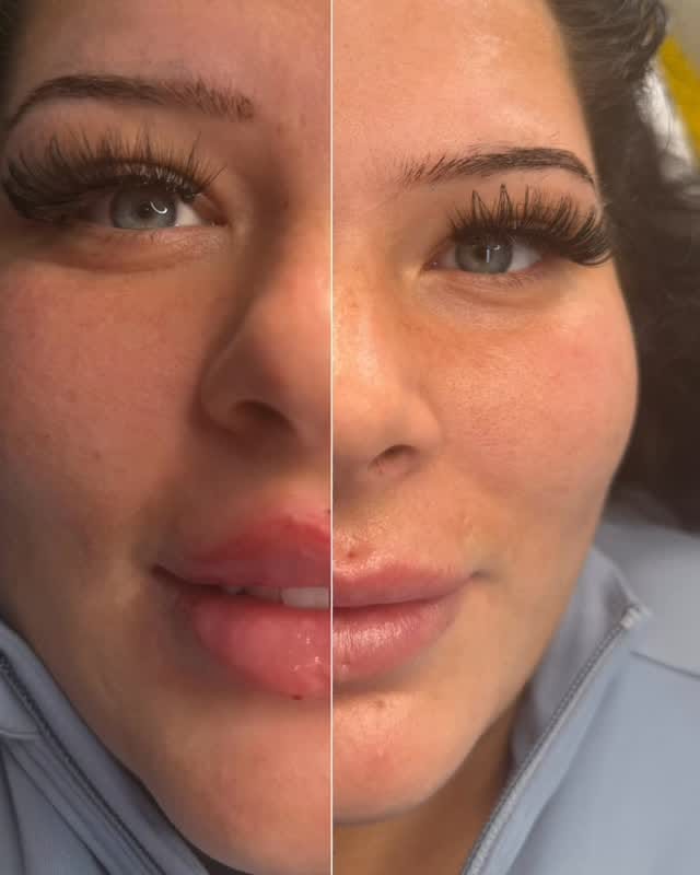 Post 3 by Retouch Aesthetics on Instagram (video)
