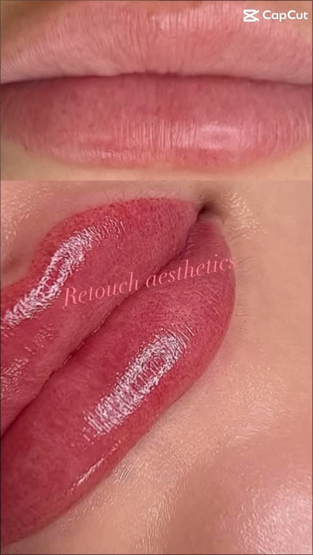 Post 9 by Retouch Aesthetics on Instagram (video)
