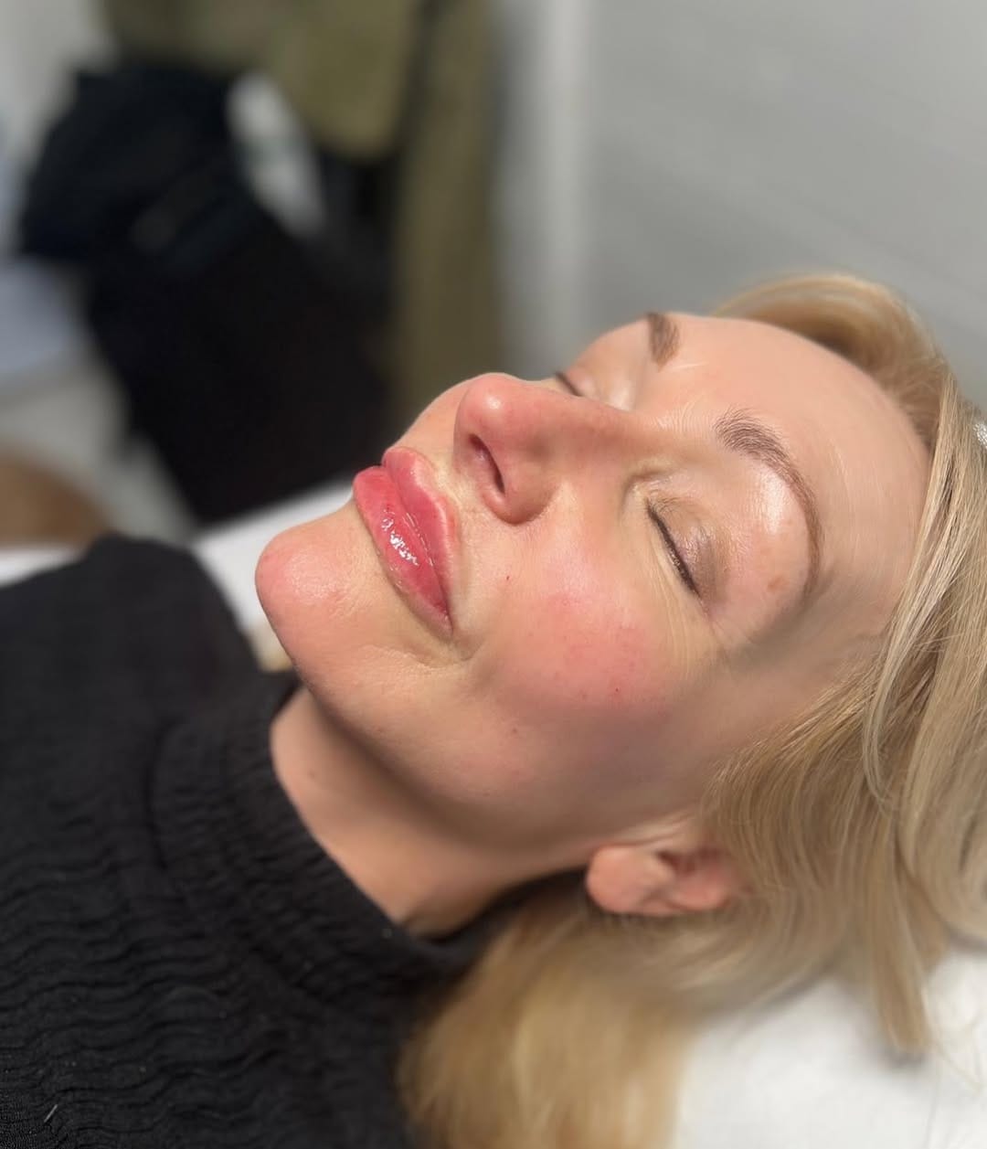 Post 5 by Carly B | Advanced Aesthetics | Anti-ageing specialist on Instagram (carousel)