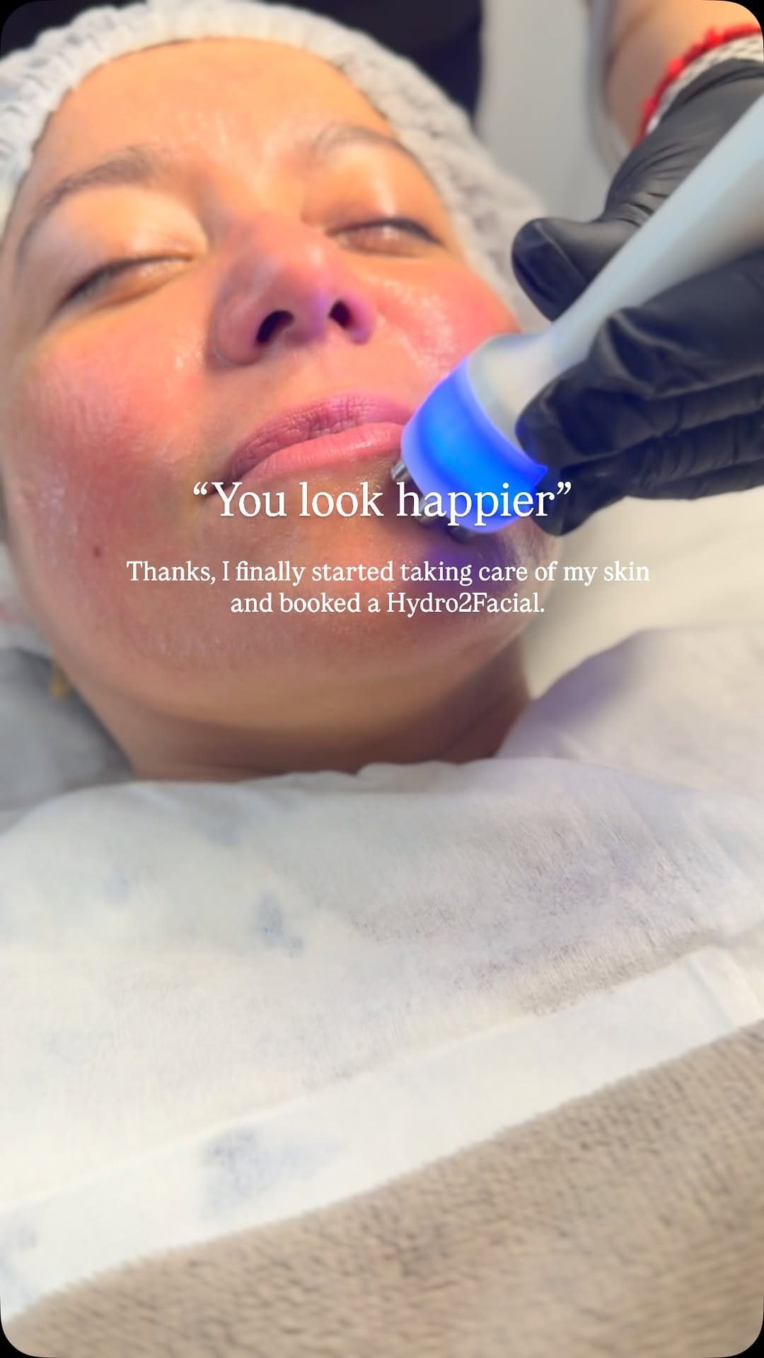 Post 1 by Soluna London | Aesthetics Clinic on Instagram (video)