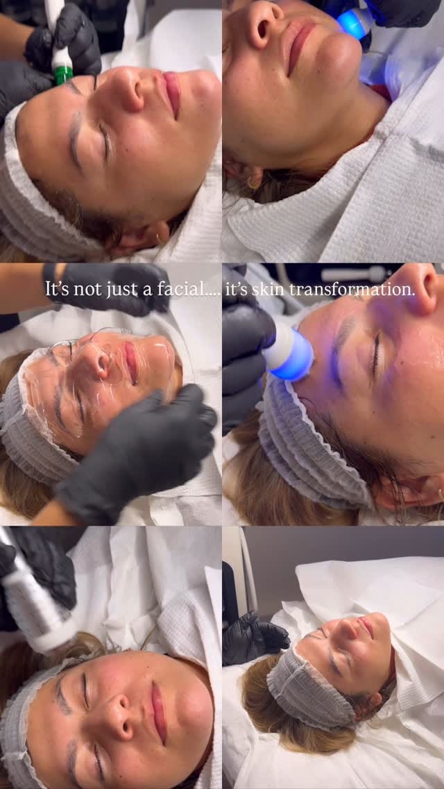 Post 7 by Soluna London | Aesthetics Clinic on Instagram (video)