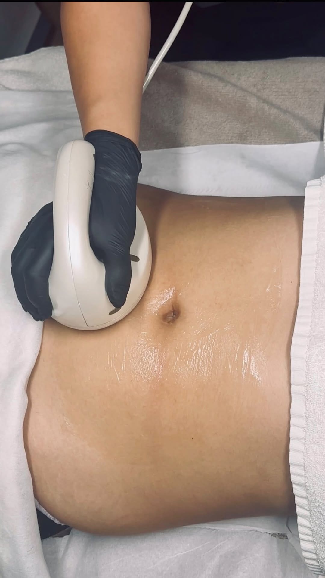 Post 10 by Soluna London | Aesthetics Clinic on Instagram (video)