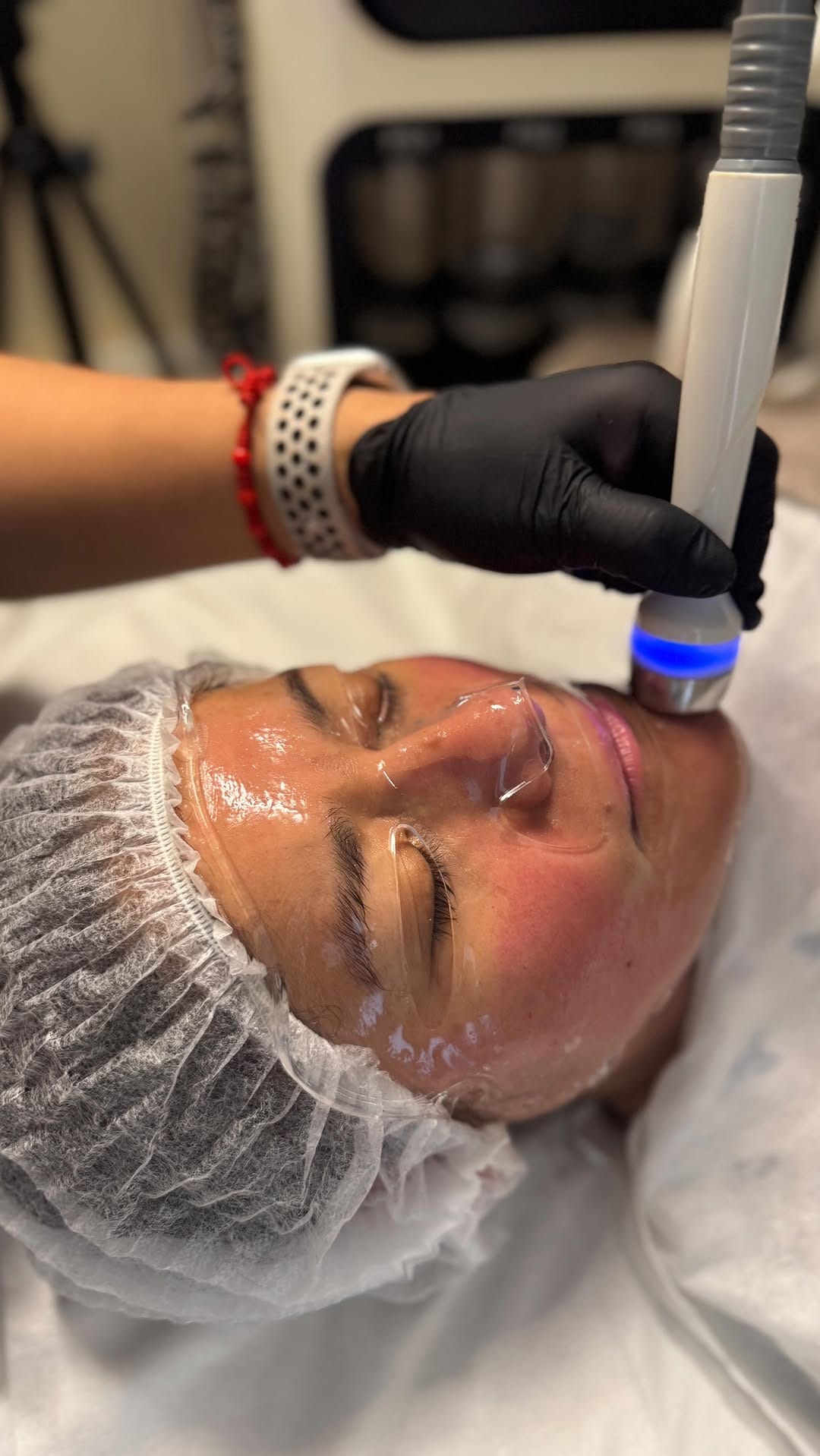 Post 8 by Soluna London | Aesthetics Clinic on Instagram (video)