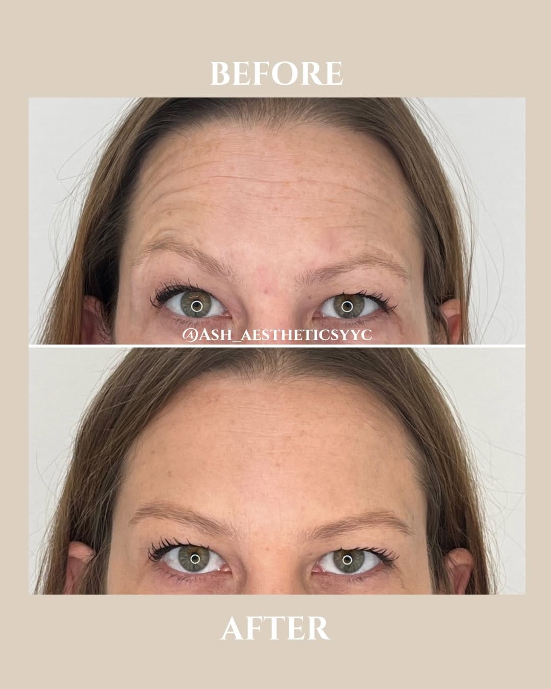 Post 10 by ENVY YYC | BOTOX + FILLER + SKIN + LASER on Instagram (carousel)